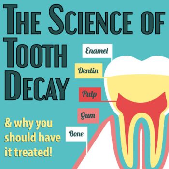 Henderson dentist, Dr. Stephen Hahn of Galleria Family Dental, discusses the science of tooth decay: what it is and what you can do to prevent it.