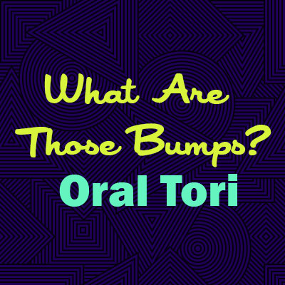 Henderson dentist, Dr. Stephen Hahn at Galleria Family Dental explains oral tori—what they are, why they happen, and whether they are a cause for concern.
